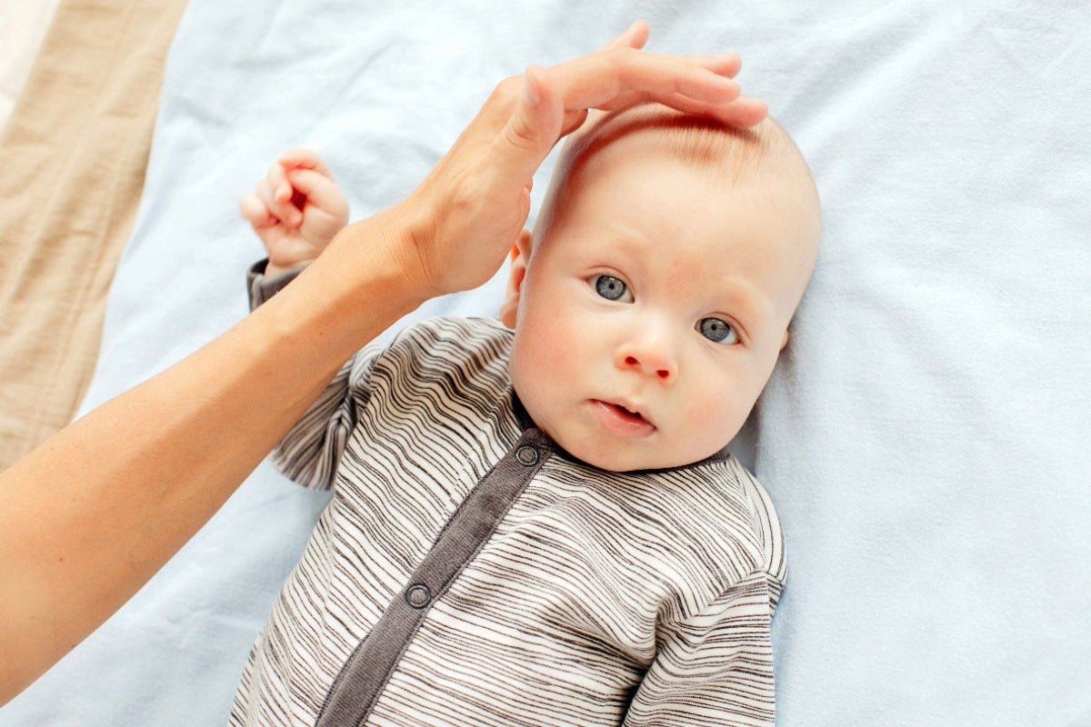 Plagiocefalia y otras deformidades craneales en bebés